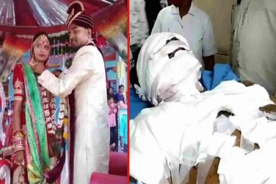 शादी के तोहफे में मिला टेडी बियर ब्लास्ट, दूल्हा जख्मी, प्रेमी ने भिजवाया था गिफ्ट