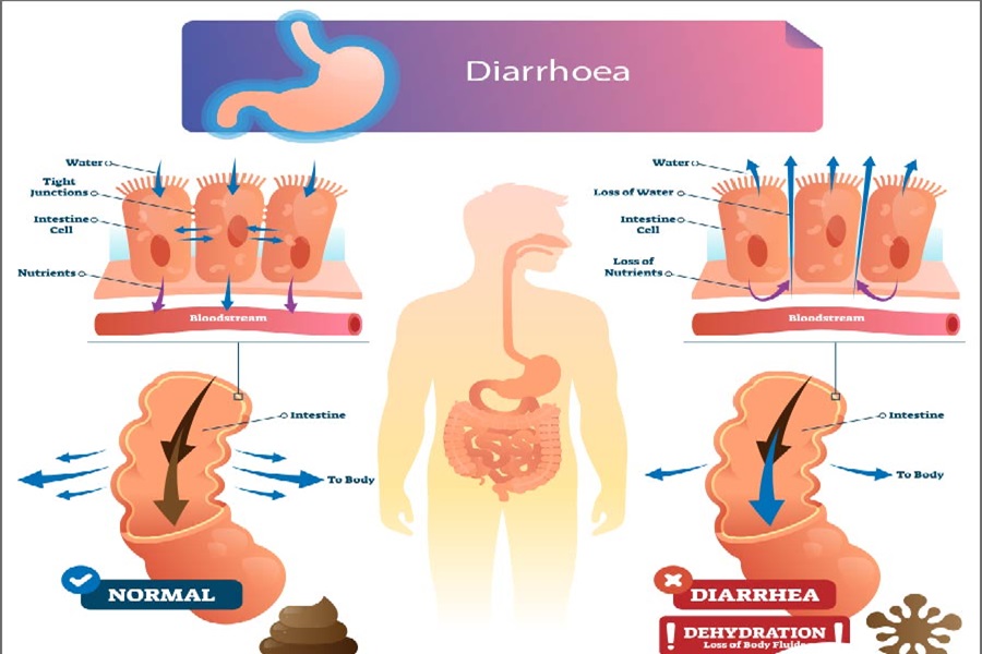 DIARRHOEA1.jpg