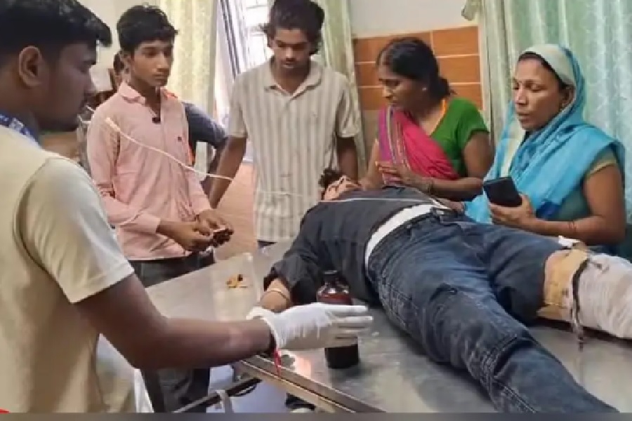 घायल के टूटे पैर पर बांधा कार्टन, छपरा सदर अस्पताल की व्यवस्था पर सवाल